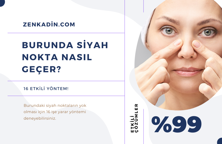 burunda siyah nokta nasil gecer